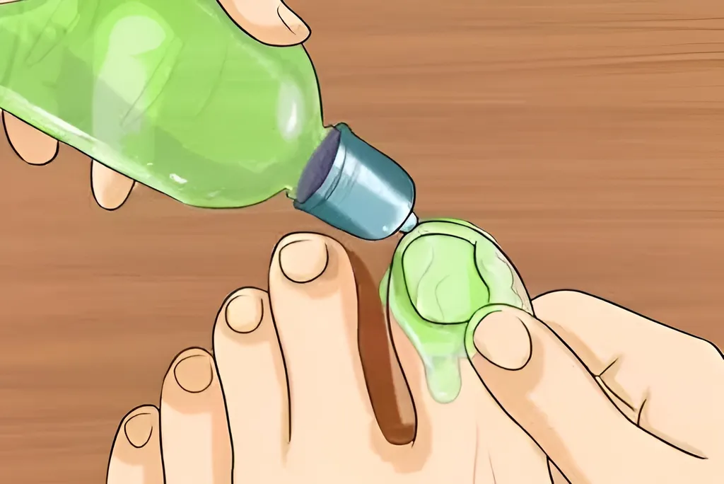 If You Have Toenail Fungus Try This Tonight (It's Genius)