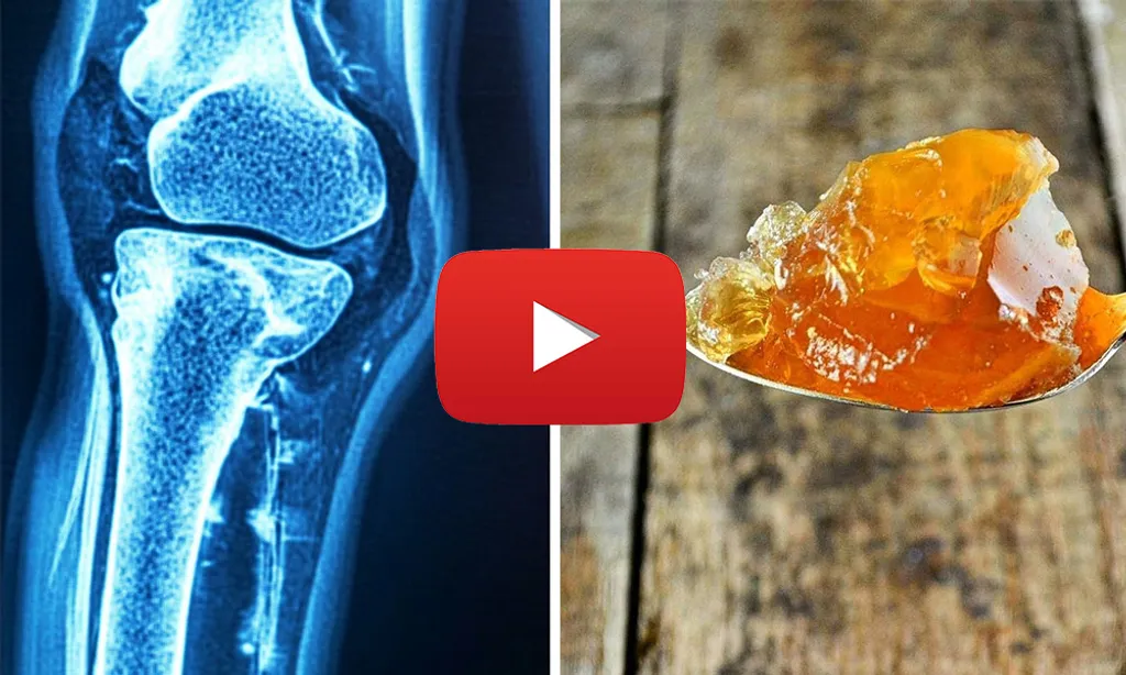 U.S. Doctor: “Arthritis Or Joint Pain? Try This Tonight”